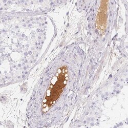 ITIH2 Antibody, Novus Biologicals 25 &mu;L, Unlabeled:Antibodies, Polyclonal